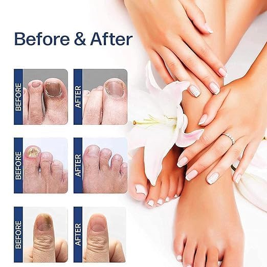 Nail Growth & Repair Serum