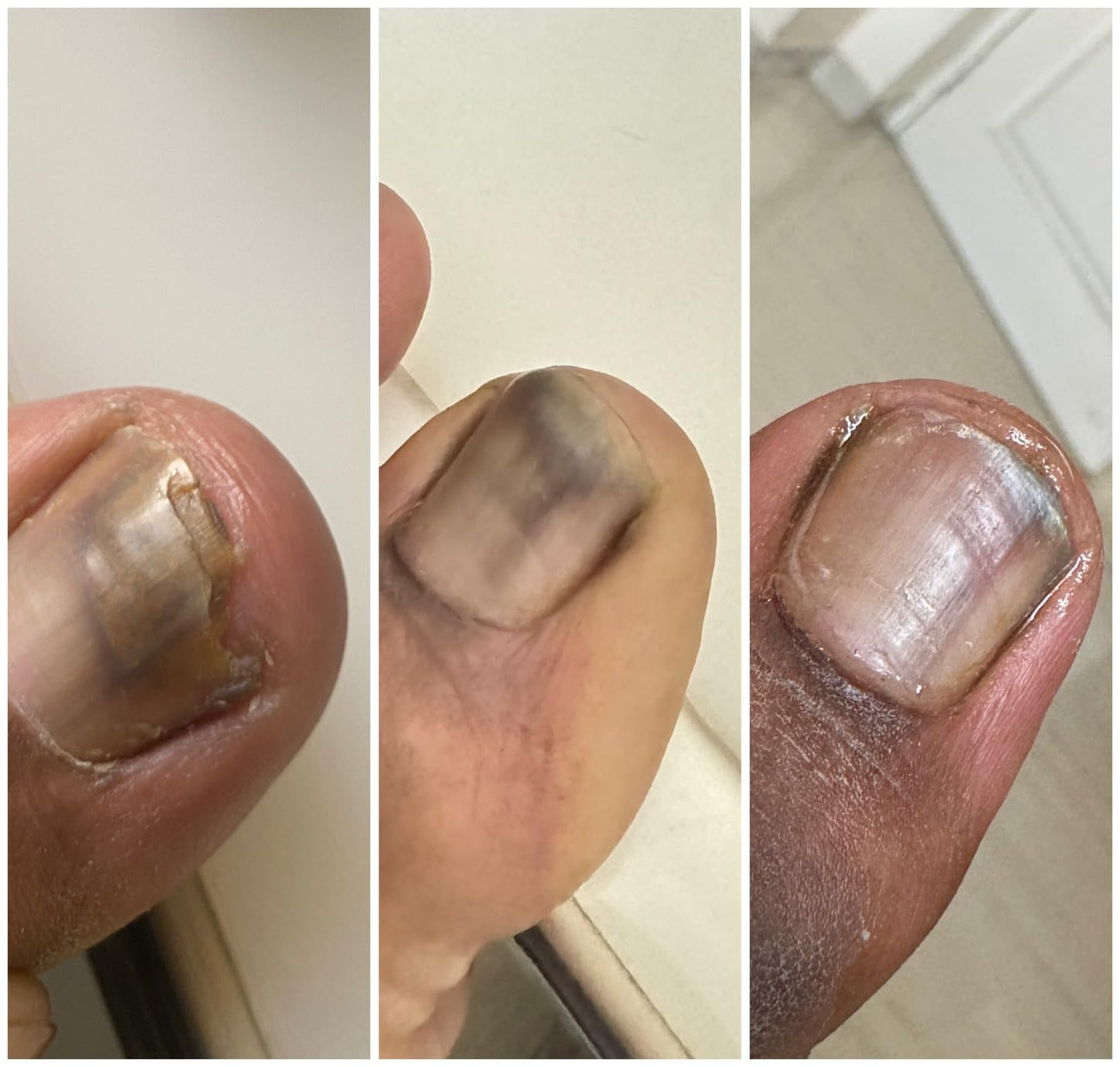 Nail Growth & Repair Serum
