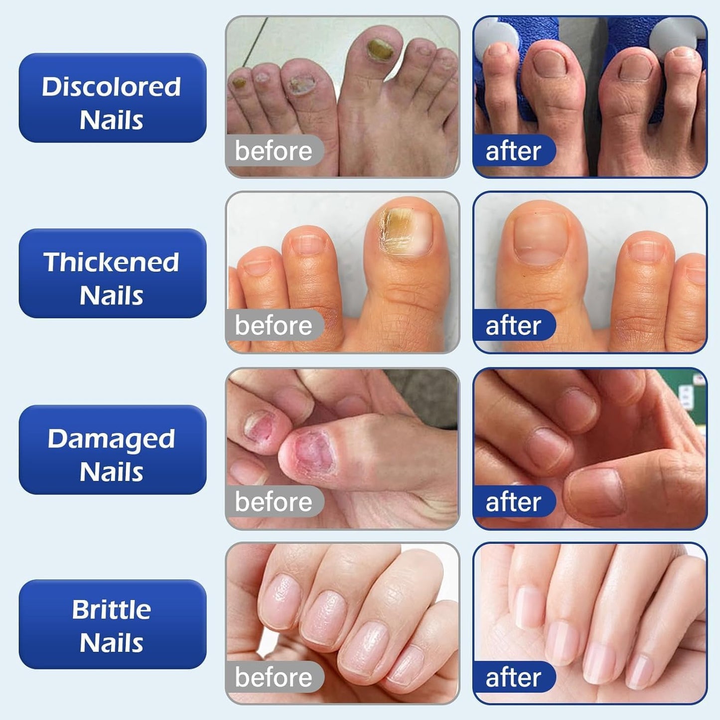 Nail Growth & Repair Serum