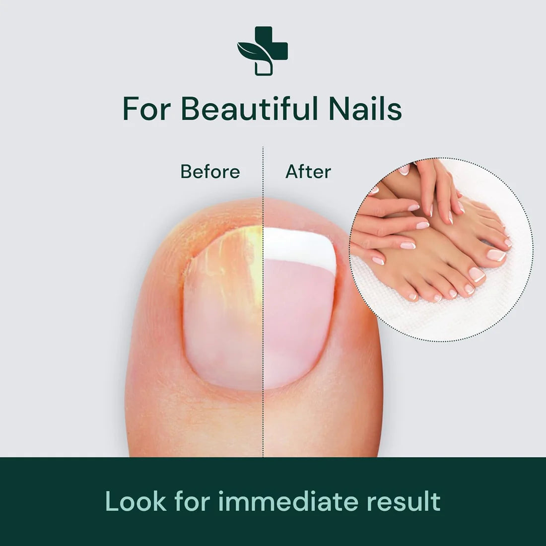 Nail Growth & Repair Serum