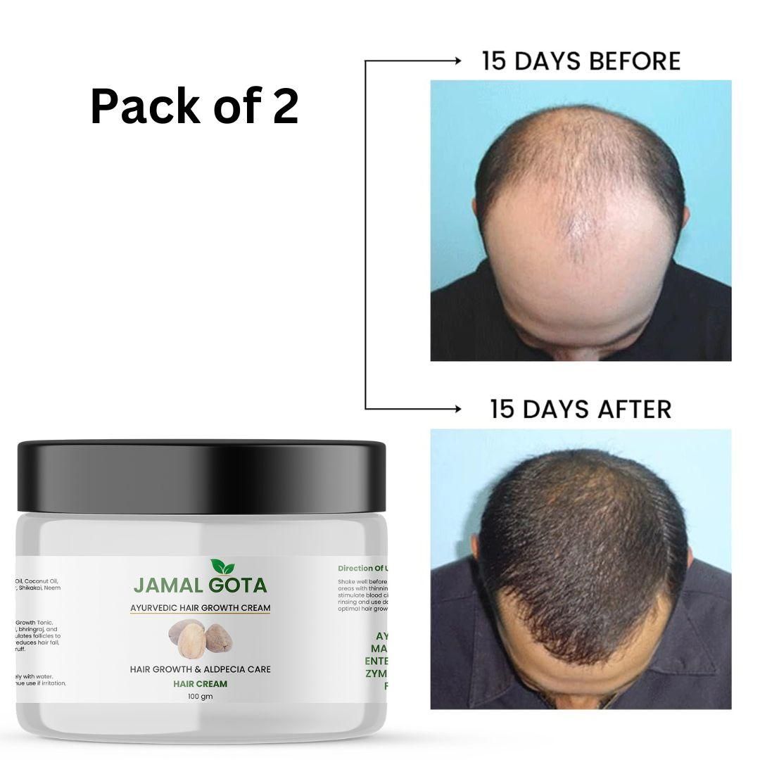 Jamalgota Ayurvedic Hair Growth Cream (Pack of 2)