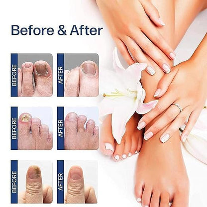 Nail Growth & Repair Serum